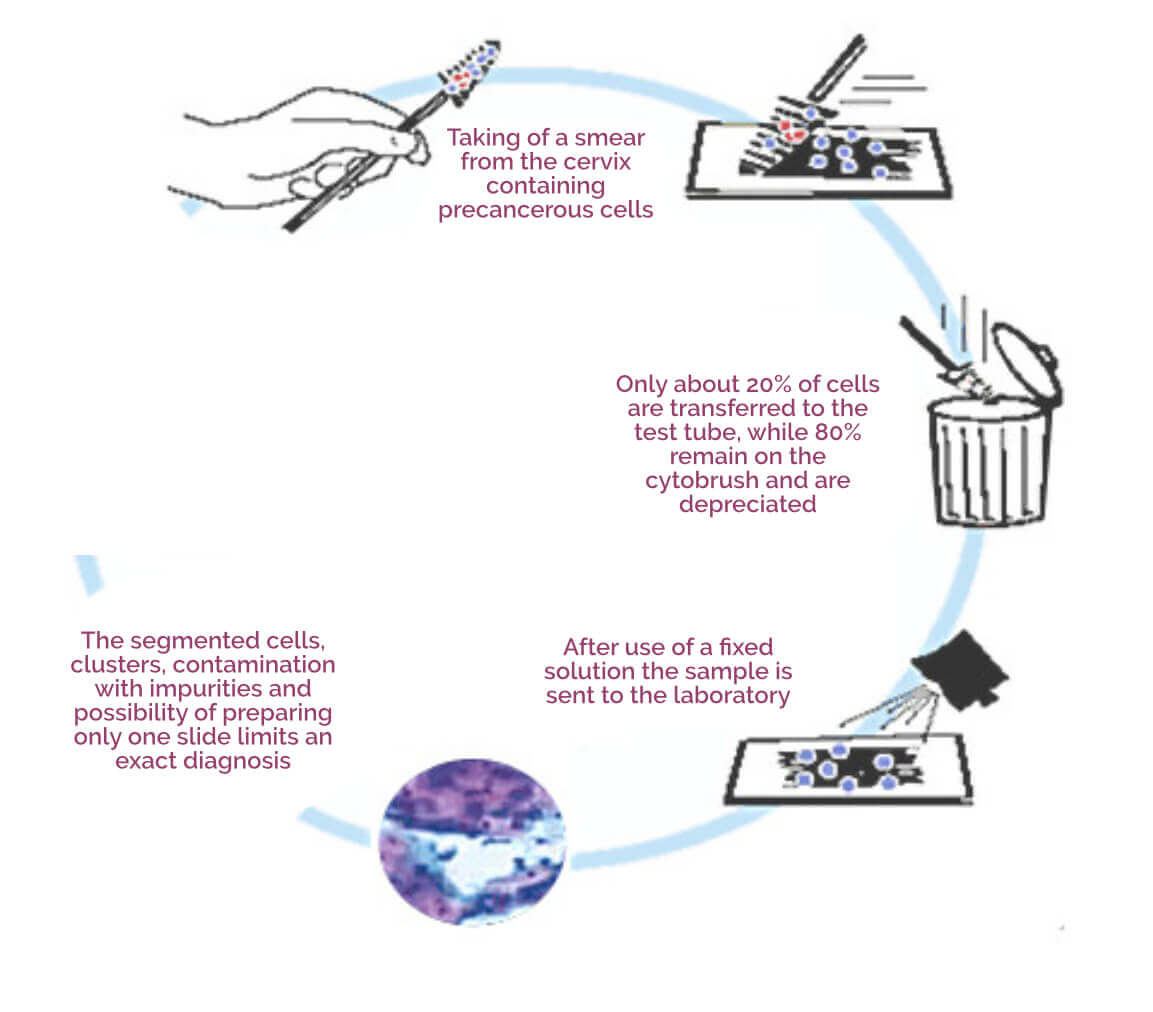 Conventional cytology